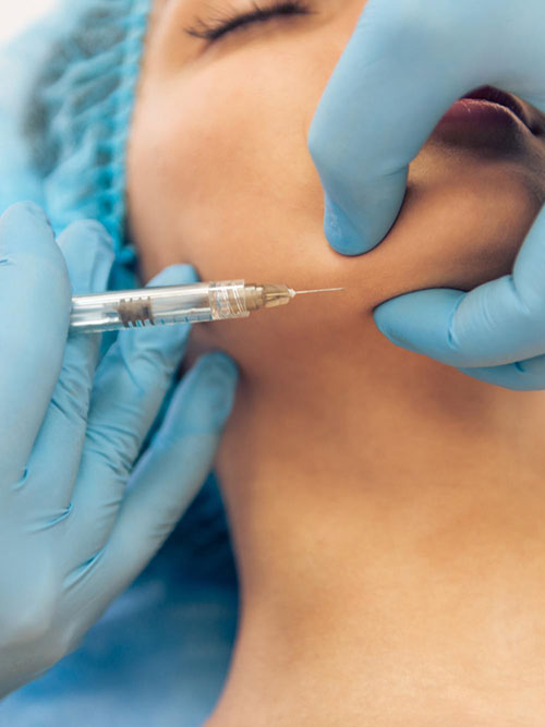 Oblikovanje Linije Čeljusti Dermalnim Fillerima