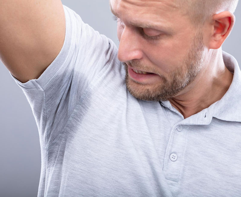 Prekomjerno Znojenje Hiperhidroza Botox